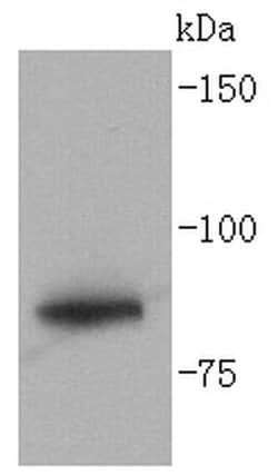 Invitrogen GYS1 Recombinant Rabbit Monoclonal Antibody (SN75-05) 100 &mu;L | Buy Online | Invitrogen&trade; | Fisher Scientific