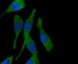 Invitrogen PPP1R1A Recombinant Rabbit Monoclonal Antibody (SN0756) 100
