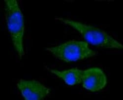 Invitrogen PPP1R1A Recombinant Rabbit Monoclonal Antibody (SN0756) 100
