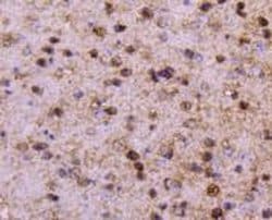 Invitrogen PPP1R1A Recombinant Rabbit Monoclonal Antibody (SN0756) 100