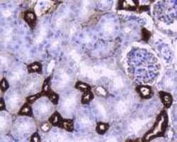 Invitrogen PPP1R1A Recombinant Rabbit Monoclonal Antibody (SN0756) 100