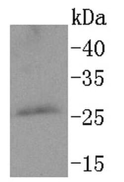 Invitrogen PPP1R1A Recombinant Rabbit Monoclonal Antibody (SN0756) 100