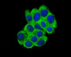 Invitrogen ABCF1 Recombinant Rabbit Monoclonal Antibody (SN07-12) 100 &mu;L;