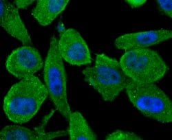 Invitrogen ABCF1 Recombinant Rabbit Monoclonal Antibody (SN07-12) 100 &mu;L;