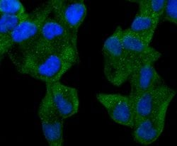 Invitrogen ABCF1 Recombinant Rabbit Monoclonal Antibody (SN07-12) 100 &mu;L;