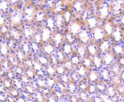 Invitrogen ABCF1 Recombinant Rabbit Monoclonal Antibody (SN07-12) 100 &mu;L;