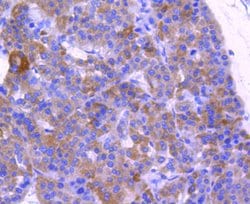 Invitrogen ABCF1 Recombinant Rabbit Monoclonal Antibody (SN07-12) 100 &mu;L;