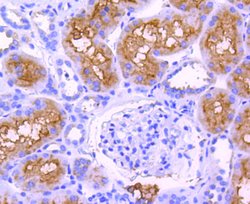 Invitrogen ABCF1 Recombinant Rabbit Monoclonal Antibody (SN07-12) 100 &mu;L;