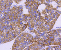 Invitrogen CPT2 Recombinant Rabbit Monoclonal Antibody (SN06-70) 100 &mu;L;