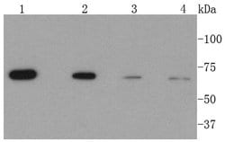 Invitrogen CPT2 Recombinant Rabbit Monoclonal Antibody (SN06-70) 100 &mu;L;