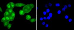 Invitrogen FANCD2 Recombinant Rabbit Monoclonal Antibody (SN73-08) 100