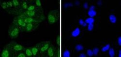 Invitrogen FANCD2 Recombinant Rabbit Monoclonal Antibody (SN73-08) 100