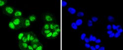 Invitrogen FANCD2 Recombinant Rabbit Monoclonal Antibody (SN73-08) 100