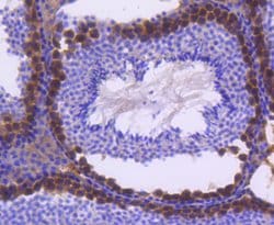 Invitrogen FANCD2 Recombinant Rabbit Monoclonal Antibody (SN73-08) 100