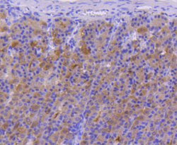 Invitrogen FANCD2 Recombinant Rabbit Monoclonal Antibody (SN73-08) 100