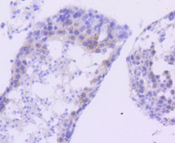 Invitrogen FANCD2 Recombinant Rabbit Monoclonal Antibody (SN73-08) 100
