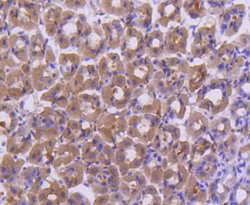 Invitrogen FANCD2 Recombinant Rabbit Monoclonal Antibody (SN73-08) 100