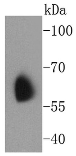 Invitrogen KV1.1 (KCNA1) Recombinant Rabbit Monoclonal Antibody (SN66-06)