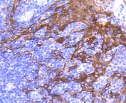 Invitrogen Cytokeratin 6 Recombinant Rabbit Monoclonal Antibody (SN71-07)