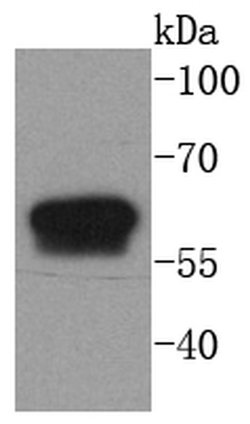 Invitrogen Cytokeratin 6 Recombinant Rabbit Monoclonal Antibody (SN71-07)