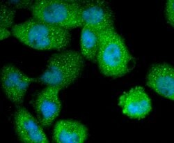 Invitrogen Cytokeratin 4 Recombinant Rabbit Monoclonal Antibody (SN74-03)