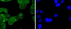 Invitrogen Cytokeratin 4 Recombinant Rabbit Monoclonal Antibody (SN74-03)