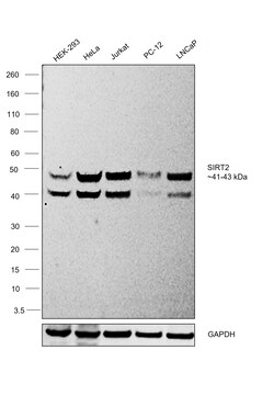 Invitrogen SIRT2 Recombinant Rabbit Monoclonal Antibody (SN70-04) 100 &mu;L | Buy Online | Invitrogen&trade; | Fisher Scientific