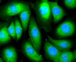 Invitrogen CA125 Recombinant Rabbit Monoclonal Antibody (SN69-06) 100 &mu;L | Buy Online | Invitrogen&trade; | Fisher Scientific