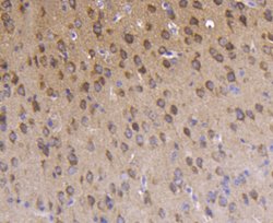 Invitrogen Phospho-PKC zeta (Thr560) Recombinant Rabbit Monoclonal Antibody (SN0753) 100 &mu;L | Buy Online | Invitrogen&trade; | Fisher Scientific