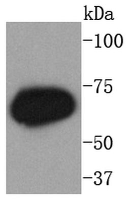 Invitrogen Phospho-PKC zeta (Thr560) Recombinant Rabbit Monoclonal Antibody (SN0753) 100 &mu;L | Buy Online | Invitrogen&trade; | Fisher Scientific