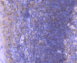 Invitrogen Bcl-10 Recombinant Rabbit Monoclonal Antibody (SN74-04) 100 &mu;L | Buy Online | Invitrogen&trade; | Fisher Scientific