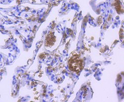 Invitrogen Hemoglobin alpha Recombinant Rabbit Monoclonal Antibody (SN70-09) 100 &mu;L | Buy Online | Invitrogen&trade; | Fisher Scientific