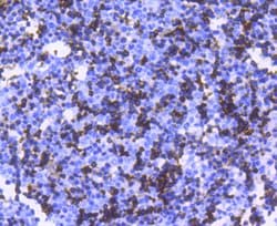 Invitrogen Hemoglobin alpha Recombinant Rabbit Monoclonal Antibody (SN70-09) 100 &mu;L | Buy Online | Invitrogen&trade; | Fisher Scientific