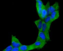 Invitrogen CD10 Recombinant Rabbit Monoclonal Antibody (SN75-07) 100 &mu;L;
