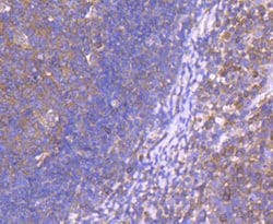 Invitrogen CD10 Recombinant Rabbit Monoclonal Antibody (SN75-07) 100 &mu;L;