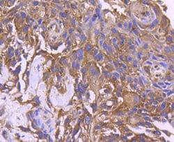 Invitrogen CD10 Recombinant Rabbit Monoclonal Antibody (SN75-07) 100 &mu;L;
