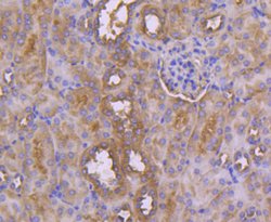 Invitrogen CD10 Recombinant Rabbit Monoclonal Antibody (SN75-07) 100 &mu;L;