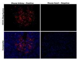 Invitrogen CD10 Recombinant Rabbit Monoclonal Antibody (SN75-07) 100 &mu;L;