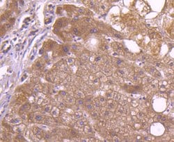 Invitrogen CD81 Recombinant Rabbit Monoclonal Antibody (SN206-01) 100 &mu;L;