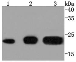 Invitrogen CD81 Recombinant Rabbit Monoclonal Antibody (SN206-01) 100 &mu;L;