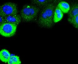 Invitrogen Cytokeratin 4 Recombinant Rabbit Monoclonal Antibody (SN2001)