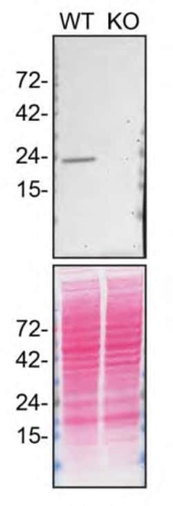 Invitrogen RAB7A Recombinant Rabbit Monoclonal Antibody (SN202-03) 100