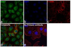 Invitrogen RAB7A Recombinant Rabbit Monoclonal Antibody (SN202-03) 100