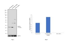 Invitrogen RAB7A Recombinant Rabbit Monoclonal Antibody (SN202-03) 100