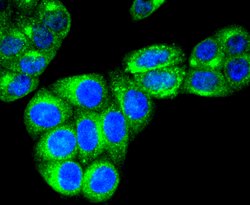 Invitrogen RAB7A Recombinant Rabbit Monoclonal Antibody (SN202-03) 100
