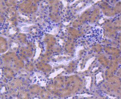 Invitrogen RAB7A Recombinant Rabbit Monoclonal Antibody (SN202-03) 100