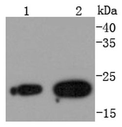 Invitrogen RAB7A Recombinant Rabbit Monoclonal Antibody (SN202-03) 100