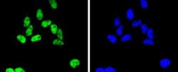 Invitrogen SMC1 Recombinant Rabbit Monoclonal Antibody (SN20-27) 100 &mu;L;