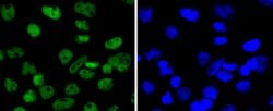 Invitrogen SMC1 Recombinant Rabbit Monoclonal Antibody (SN20-27) 100 &mu;L;
