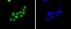 Invitrogen SMC1 Recombinant Rabbit Monoclonal Antibody (SN20-27) 100 &mu;L;